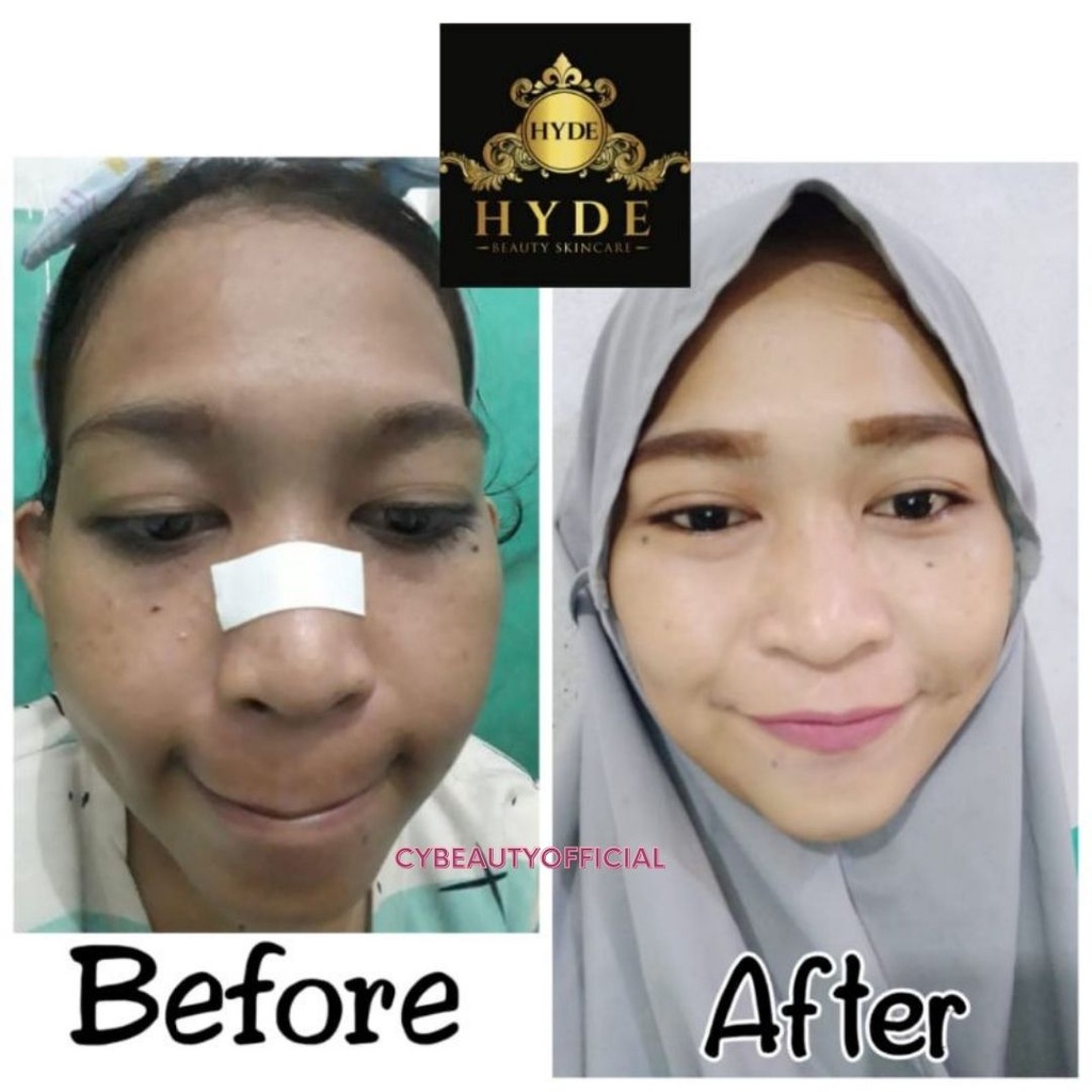 Hyde Skincare Original All Paket dan ecer All Varian