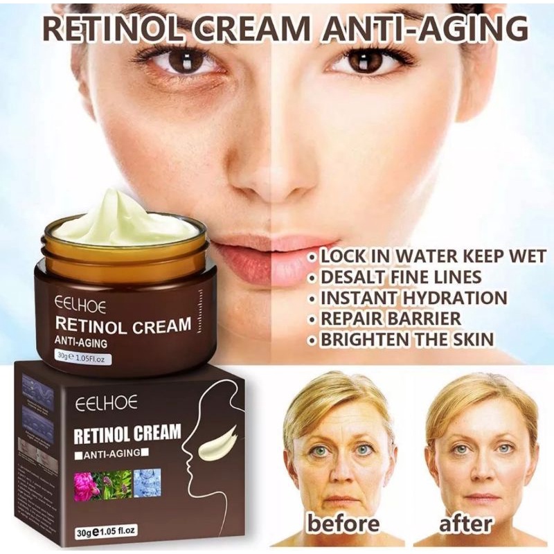 ORIGINAL EELHOE RETINOL 30GR CREAM PEMUTIH PELEMBAB HILANGKAN KERUT WAJAH