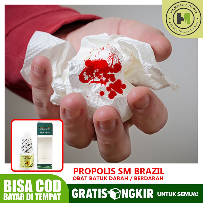 

Obat Batuk Darah, batuk membandel, batuk menahun, TBC Terlaris No.1 Terbukti Aman Propolis SM