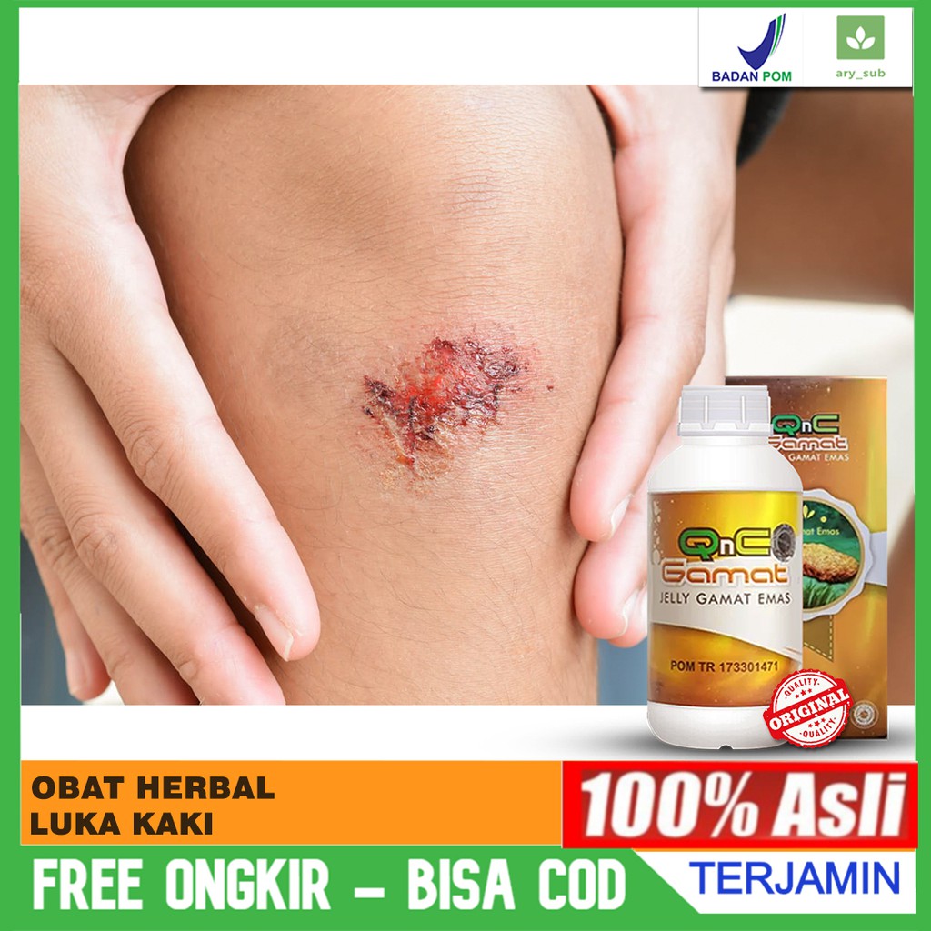 Obat Luka Di Kaki - Obat Luka Diabetes - Obat Luka Kaki Bengkak Herbal Laris QnC Jelly Gamat Alami