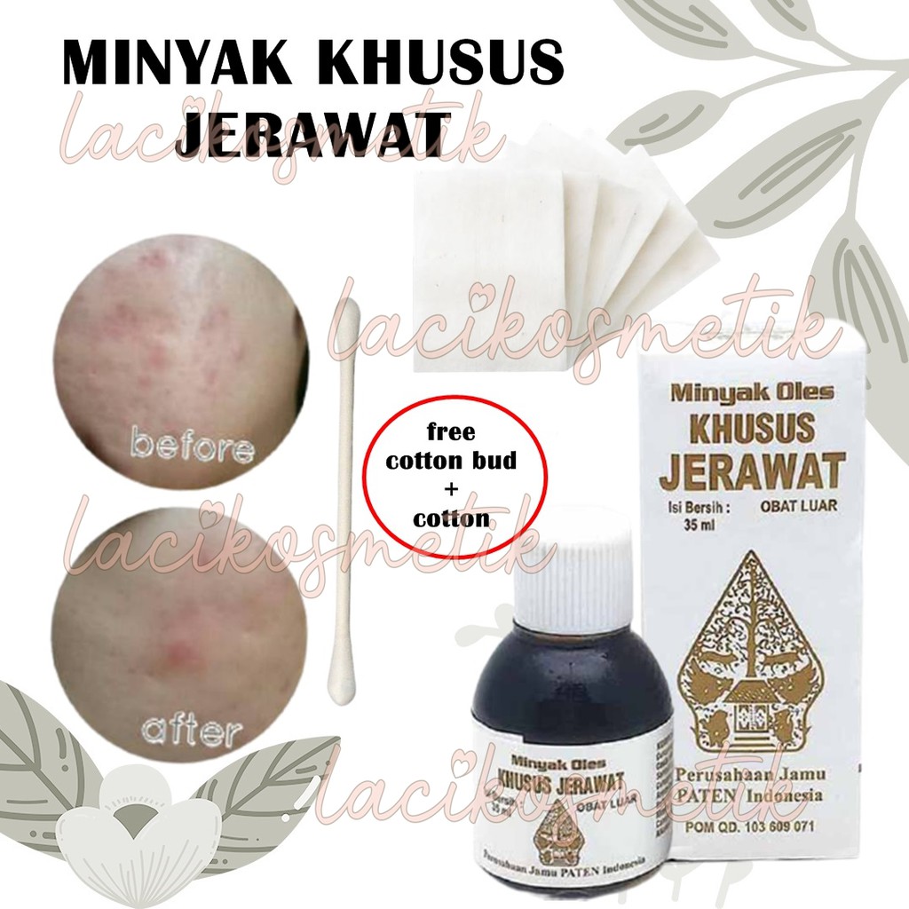 ✨LACIKOSME✨ OBAT JERAWAT WAYANG