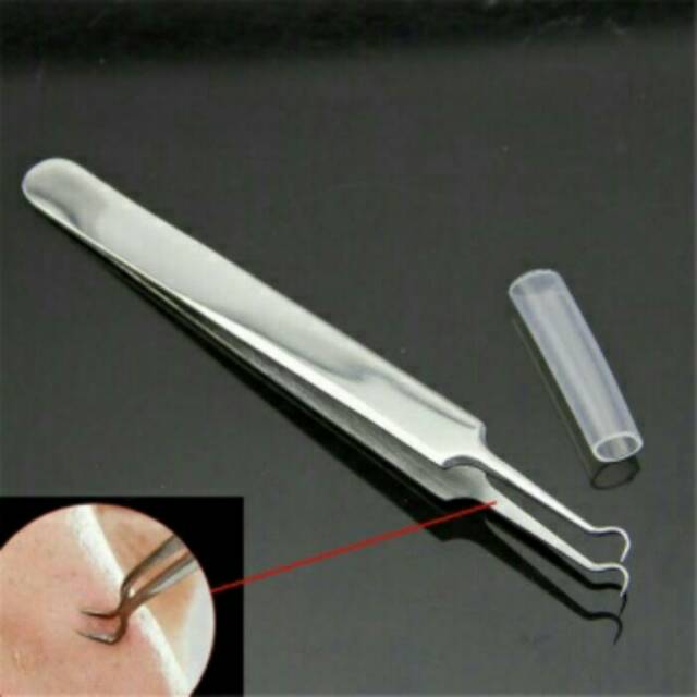 pinset komedo - alat pembersih komedo - blackhead remover