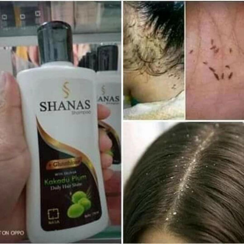 SHAMPO ANTI KUTU / SHAMPO PEMBASMI KUTU / SAMPO ANTI GATAL / SAMPO ATASI KETOMBE / SAMPO RAMBUT RONT