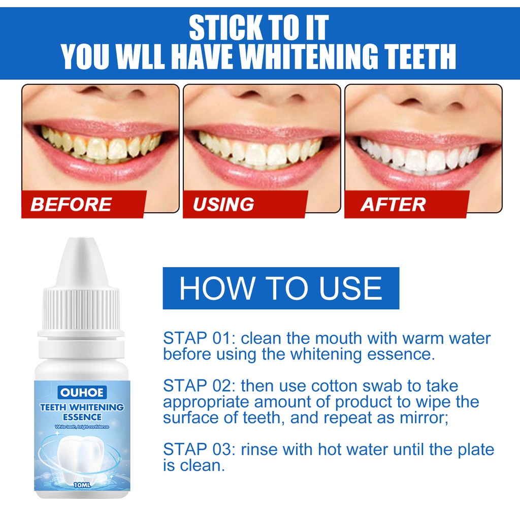 Esensi pemutih gigi Whitening teeth Cairan 10ml Menghapus Noda asap karang gigi kalkulus Kebersihan mulut Esensi pembersih Nada segar