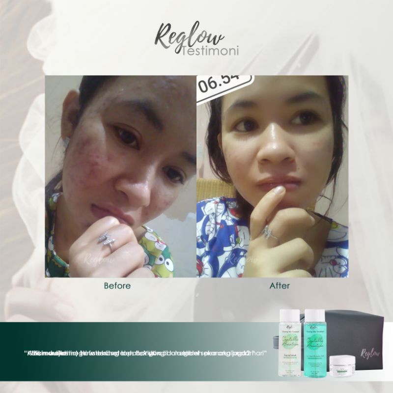 Reglow Perawatan Pencerah Wajah Original Glowing Skin Treatment Skincare BPOM-1