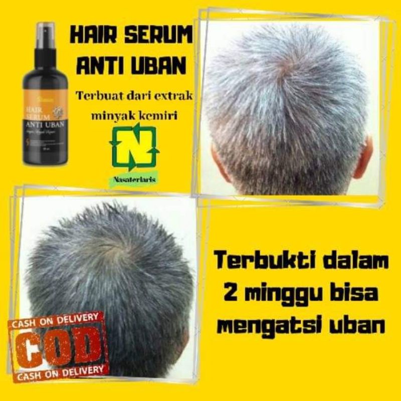 SHANAS Serum Anti Uban Penghitam Rambut Uban BPOM Nasa Perawatan Rambut Uban