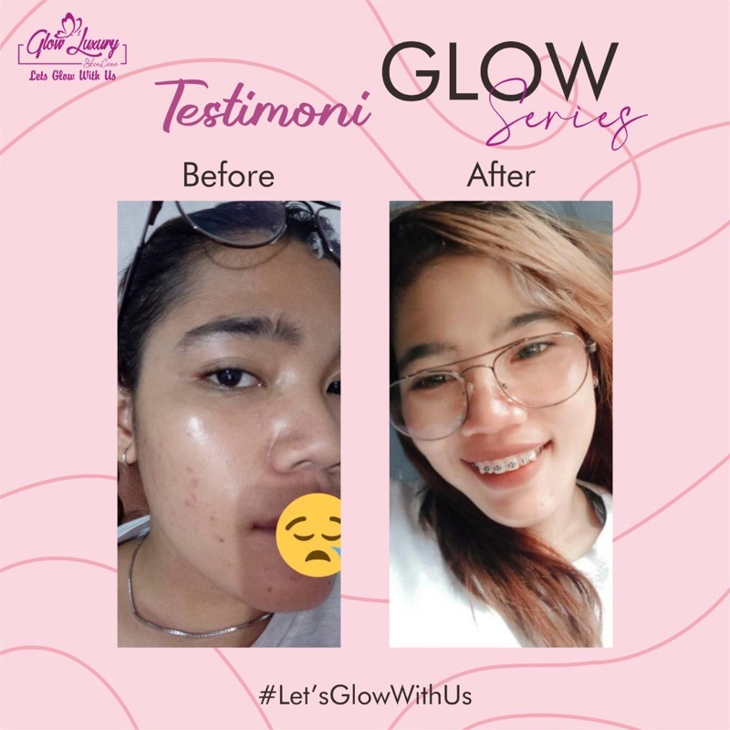 Paket GLOW LUXURY series glow BPOM