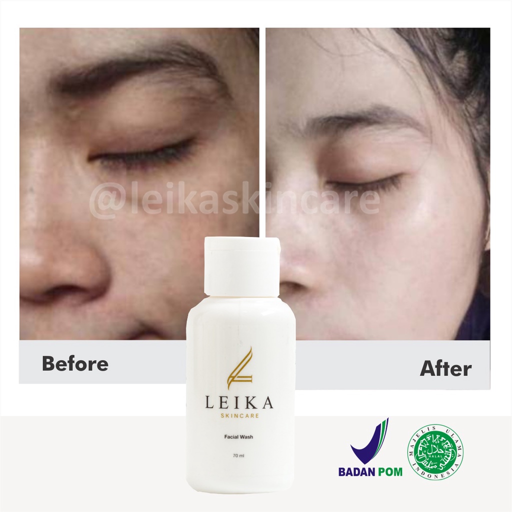 Mantap! Sabun Wajah Penyegar Pelembab Kulit Wajah Anti Aging Penyembuhan Luka Jerawat Pengangkat Sel sel Kulit Mati Penghalus Kulit Wajah Pembersih Pori-pori Wajah Pereda Peradangan Akibat Jerawat Facial Wash Skincare Resmi BPOM