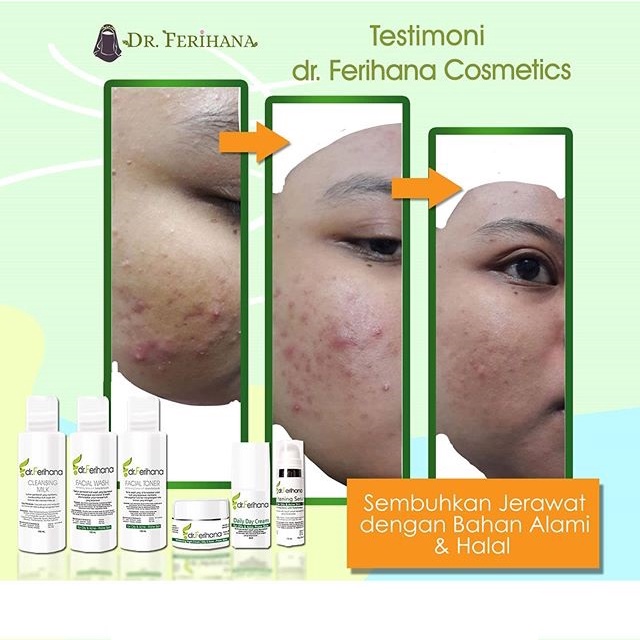 Galactomyces Day Cream For Oily &amp; Acne - Prone Skin DR. FERIHANA COSMETICS &amp; SKINCARE Krim Siang untuk Mengatasi Kulit Berminyak Berjerawat Bekas Jerawat Mencerahkan Sekaligus Anti Aging BPOM LPPOM HALAL MUI