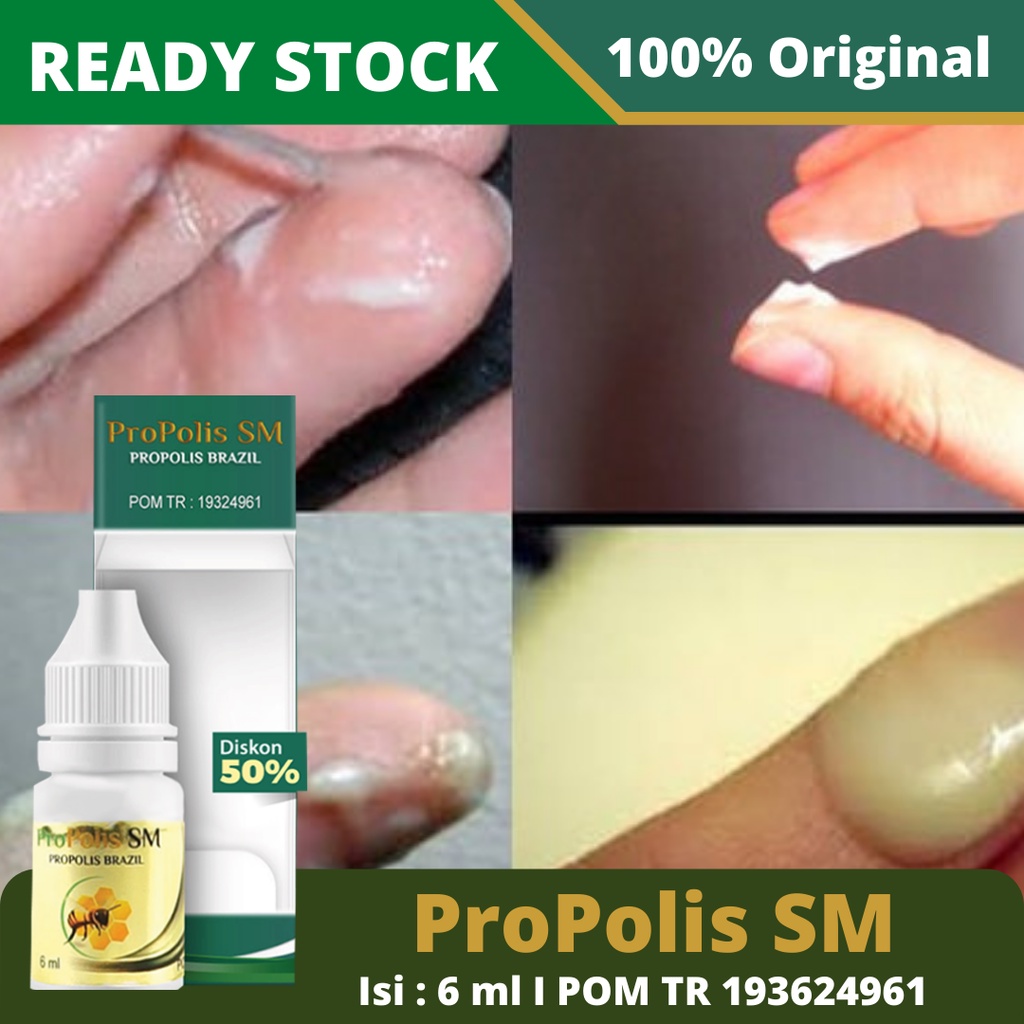 Obat Bau Keputihan, Nyeri Saat Haid, Pelancar Haid, Jamu Pelancar Haid, Sumilangeun, Radang Panggul, Turun Peranakan, Rahim Turun, Keputihan Abnormal, Infeksi Keputihan Dengan Propolis SM Brazil 100% Asli