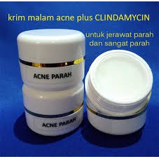 Krim Malam acne parah plus clindamycin untuk jerawat parah dan sangat parah