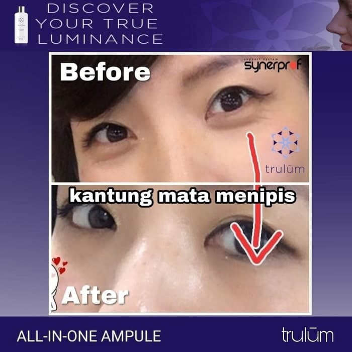 Trulum 5Ml/15Ml/120Ml/Perawatan Kulit Wajah Keriput