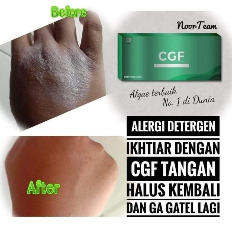 CGF (CHLORELLA GROWTH FACTOR)