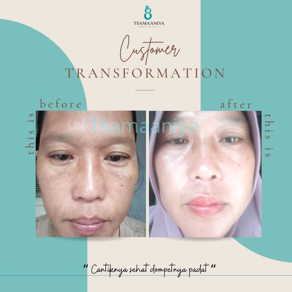 Tsamaaniya skincare SERUM FLEK 12.5 ML (BISA COD)