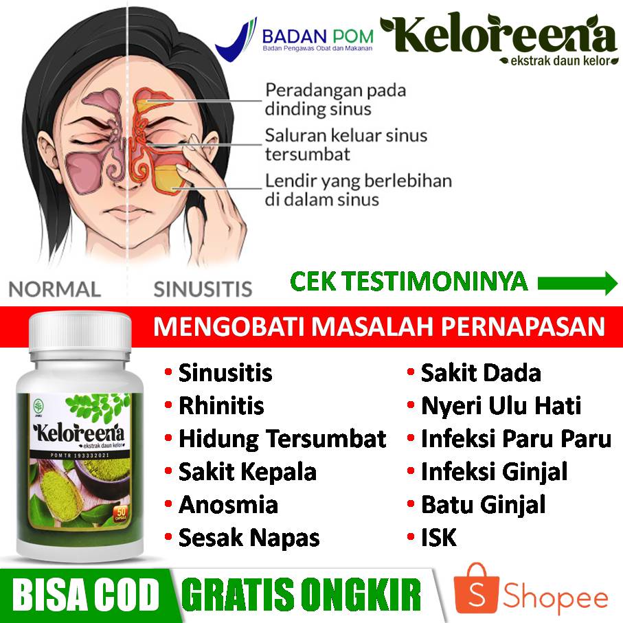 Jual Obat Herbal Sinusitis, Infeksi, Radang Sinusitis, Rhinitis, Hidung ...