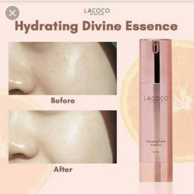 HDE LACOCO NASA / Hydrating Divine Essence Lacoco Nasa Penghalus wajah & Memudarkan Bopeng di Wajah