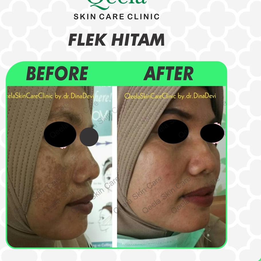 Baru - Qeela Skincare - Krim Pagi Whitening BPOM / Krim Pagi Untuk Flek Hitam / Sunscreen Brightenin