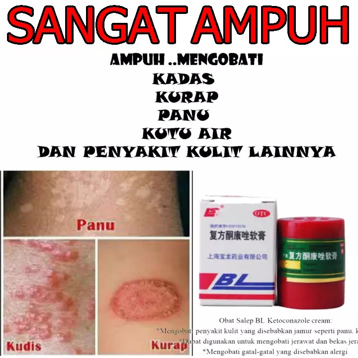 obat gatel gatal dan penyakit kulit salep BL original SANGAT AMPUH-1