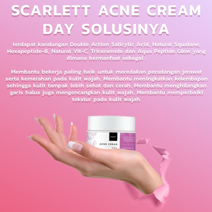 SCARLETT SCARLET WHITENING ACNE DAY CREAM KRIM JERAWAT CREAM SIANG MAKIN GLOWING