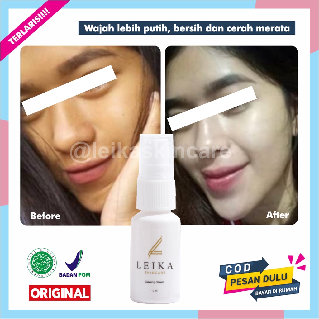 Serum Pemutih Wajah Wanita Glowing BPOM Serum Pemutih Wajah Cepat Halal Serum Untuk Pemutih Wajah Pr