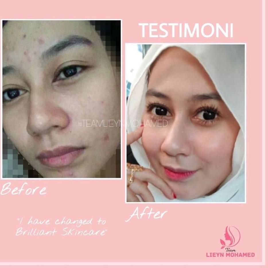 Harga Brilliant Skin Rejuvenating Skincare Terbaru November 2021 Biggo Indonesia