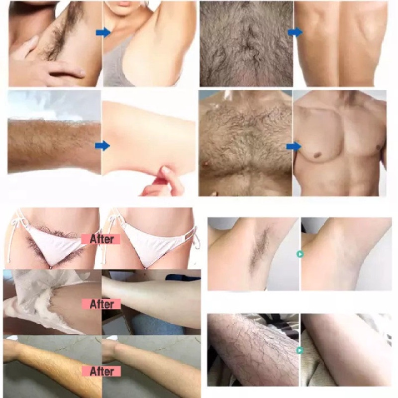 Spray Penghilang Rambut Hair Removal Krim Pemutih Dan Penghilang Rambut Hair Removal Wax 120ml Spray Busa Menghambat Pertumbuhan Rambut Alat Penghilang Bulu Dengan Lembut Tanpa Rasa Sakit Untuk Bagian Pribadi, Tangan Dan Kaki