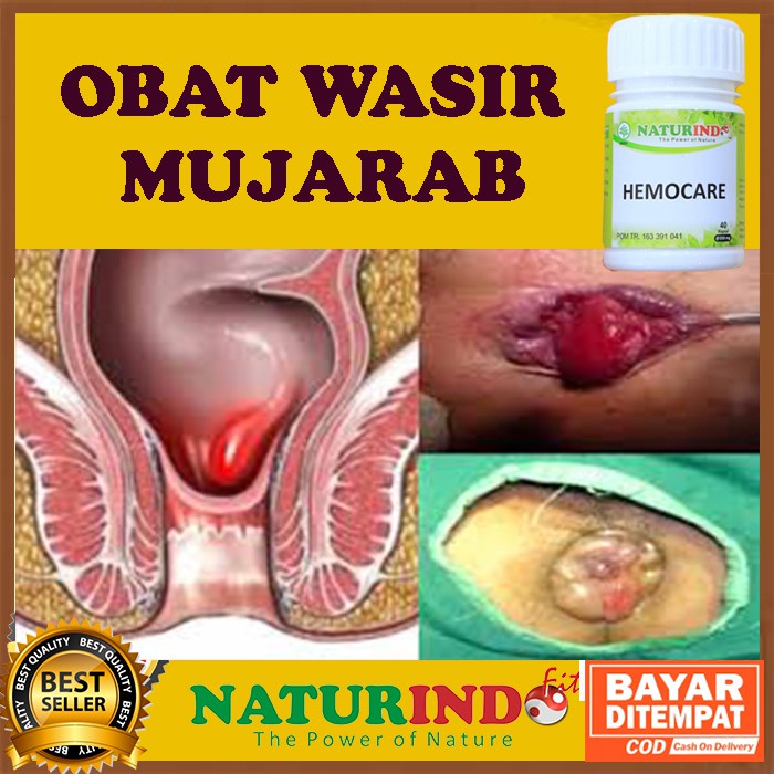 Ori Obat Wasir Ambeien stadium 1 sampai 4 paling ampuh Herbal ambeyen Ambeien Hemoroid Hemocare Natu