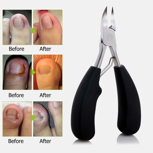 Gunting Kuku Jempol Kaki Anti Cantengan Gunting Pemotong Kuku Jempol Kaki Toe Nail Clipper Edge Cutter Gunting Kuku Jempol Kaki Miring Stainless