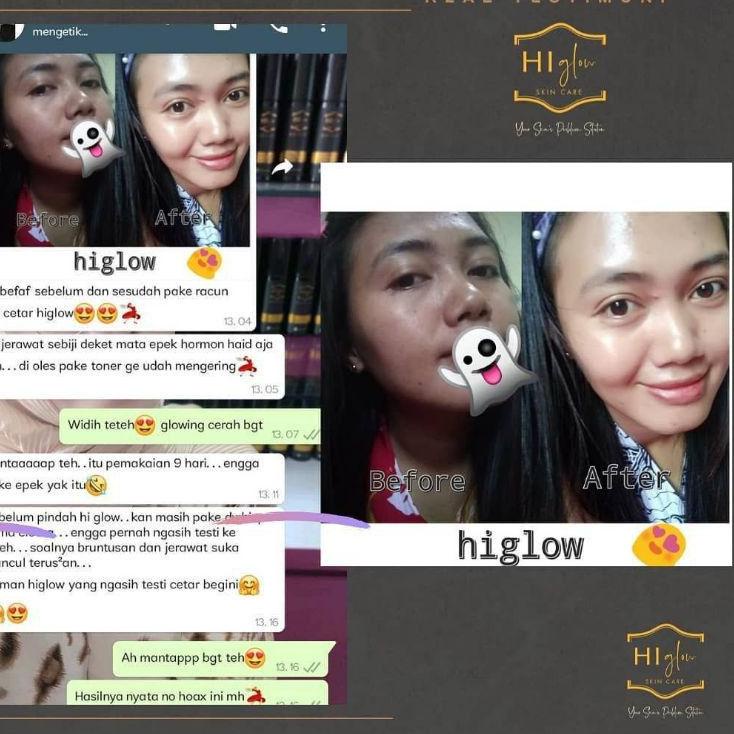 Lagi.diskon HI GLOW SKINCARE ORIGINAL BPOM Nk✬