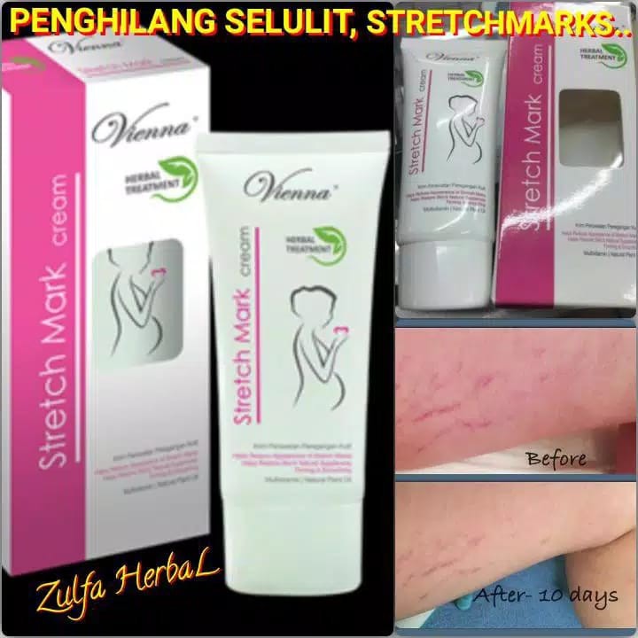 PENGHILANG STRECHMARK VIENNA STRETCH MARK CREAM  STRETCH MARK CREAM STRETCHMARK CREAM