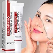 Cream Penghilang Flek Bintik Wajah Freckle