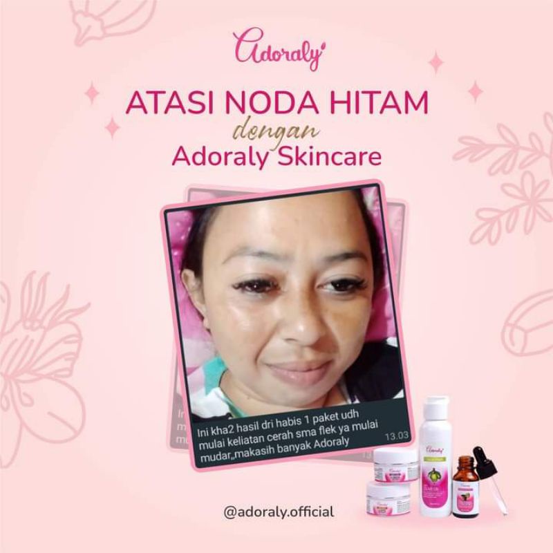 1PAKET ADORALY SKINCARE ORIGINAL BPOM/mengatasi kulit kusam berjerawat