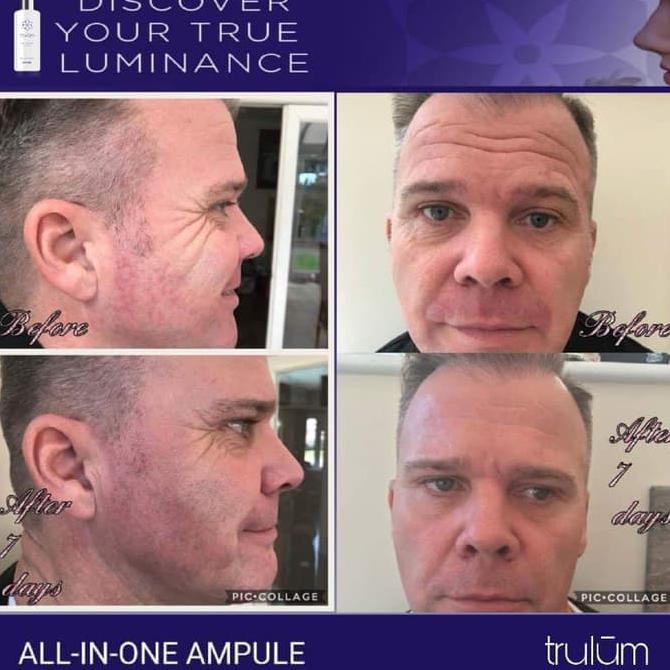 Krim Crem Pemutih Wajah Pria Wanita | Skincare Anti Aging Paling Ampuh