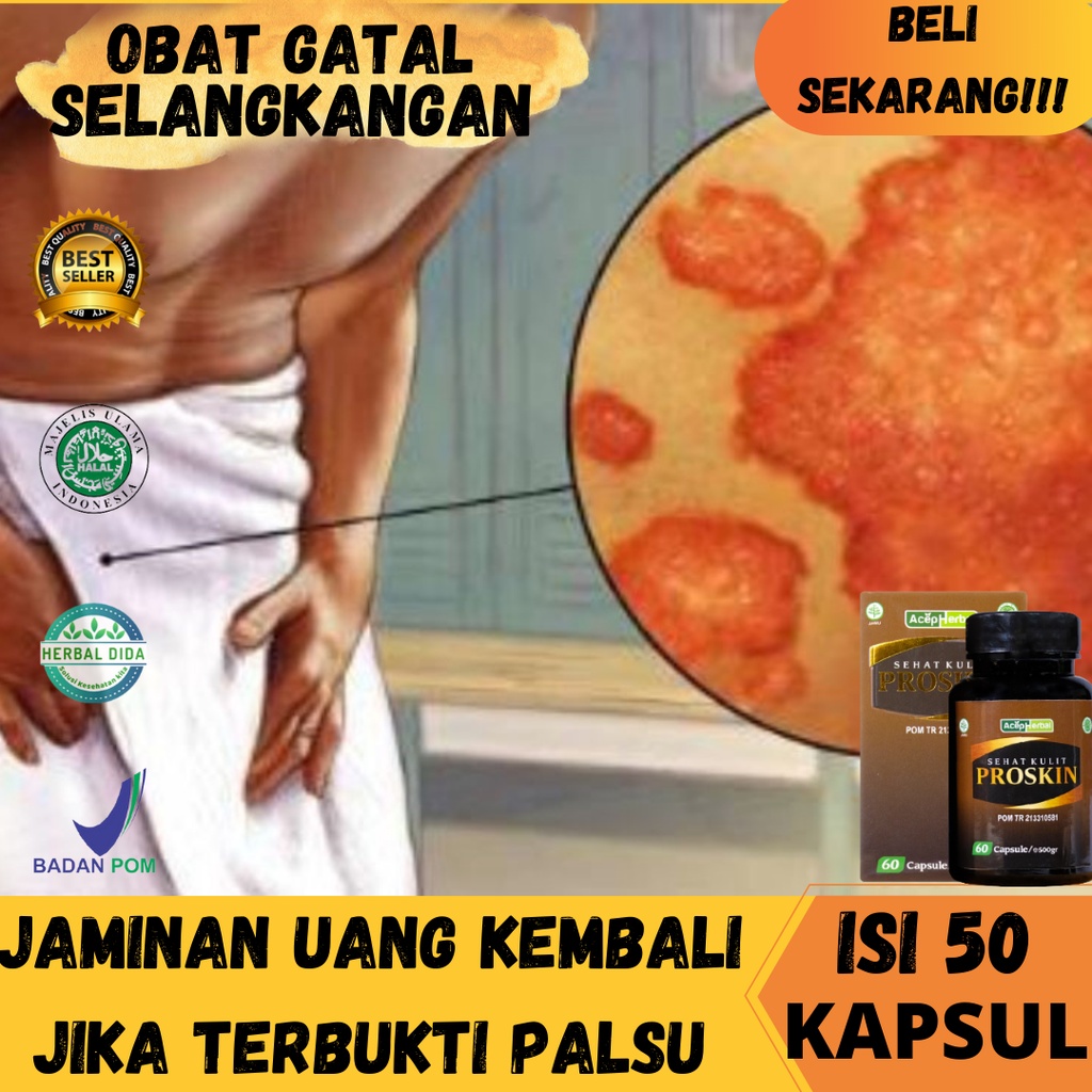 Obat Gatal Jamur Selangkangan, Obat Gatal Selangkangan Menahun, Obat Gatal Panu Kurap Selangkangan, 