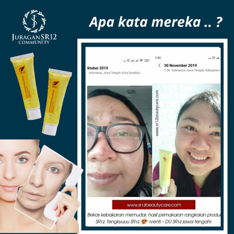 WHITENING TERBAIK!! PENCERAH WAJAH / PENGENCANG ANTI KERUT WAJAH / HERBAL TIGHTENING CREAM SR12