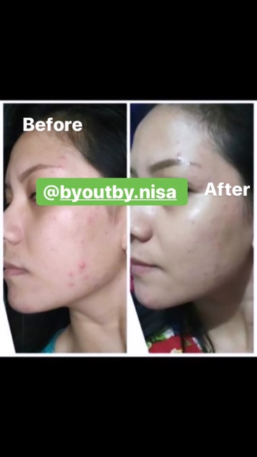 TONER KULIT NORMAL PEMUTIH EXTRA WHITENING ORI BPOM KRIM FARMA CREAM DOKTER HALAL AMPUH BUMIL BUSUI