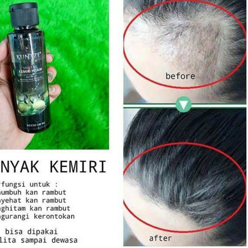 MINYAK RAMBUT KEMIRI/MINYAK RAMBUT KUNTZE/MINYAK KEMIRI BPOM/MINYAK KEMIRI HITAM