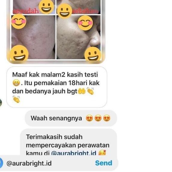 ♛ ( Bisa ) AURA BRIGHT GLUTATHIONE VIT C SERUM - SERUM VIT C WAJAH AURA BRIGHT ASLI ♢