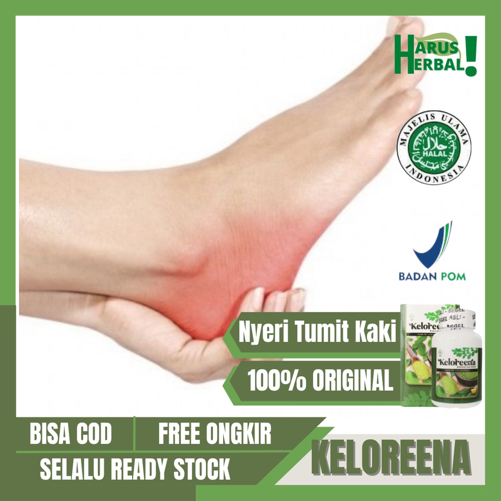 Obat Nyeri Tumit Kaki, Obat Sakit Tumit Alami, Tumit Bengkak, Obat Pereda Nyeri Tumit, Obat Radang T