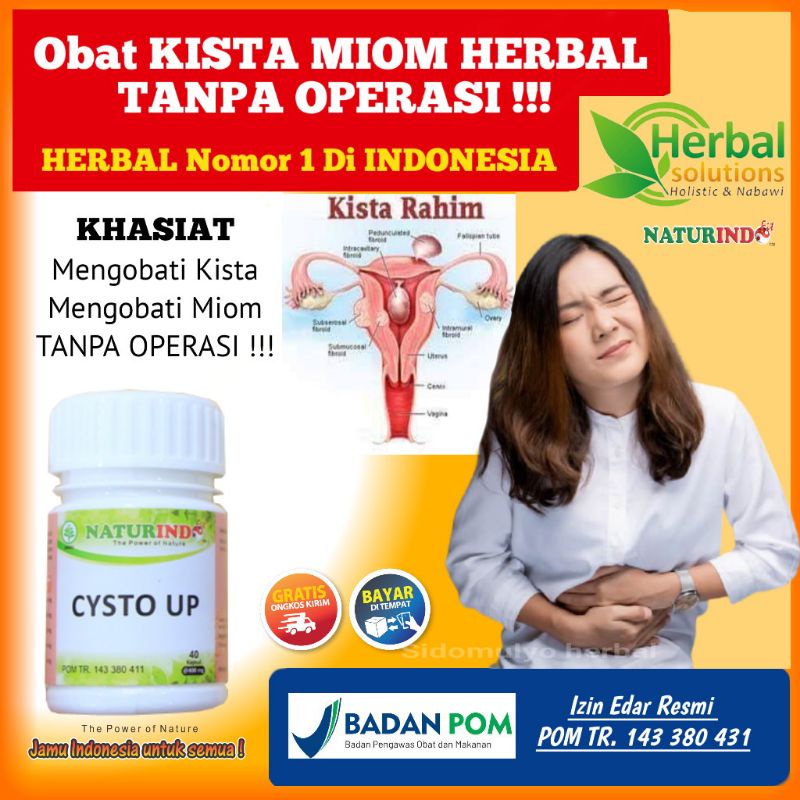 OBAT KISTA CYSTA MIOM HERBAL TANPA OPERASI