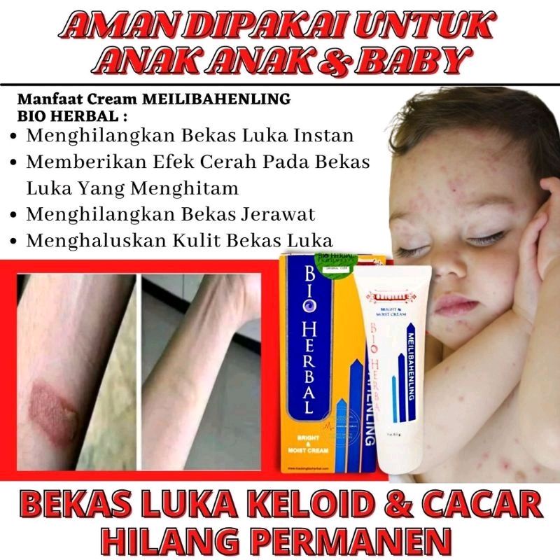 Jual [cod] Penghilang Bekas Luka Ampuh 7 Hari Bisa Untuk Flek Hitam