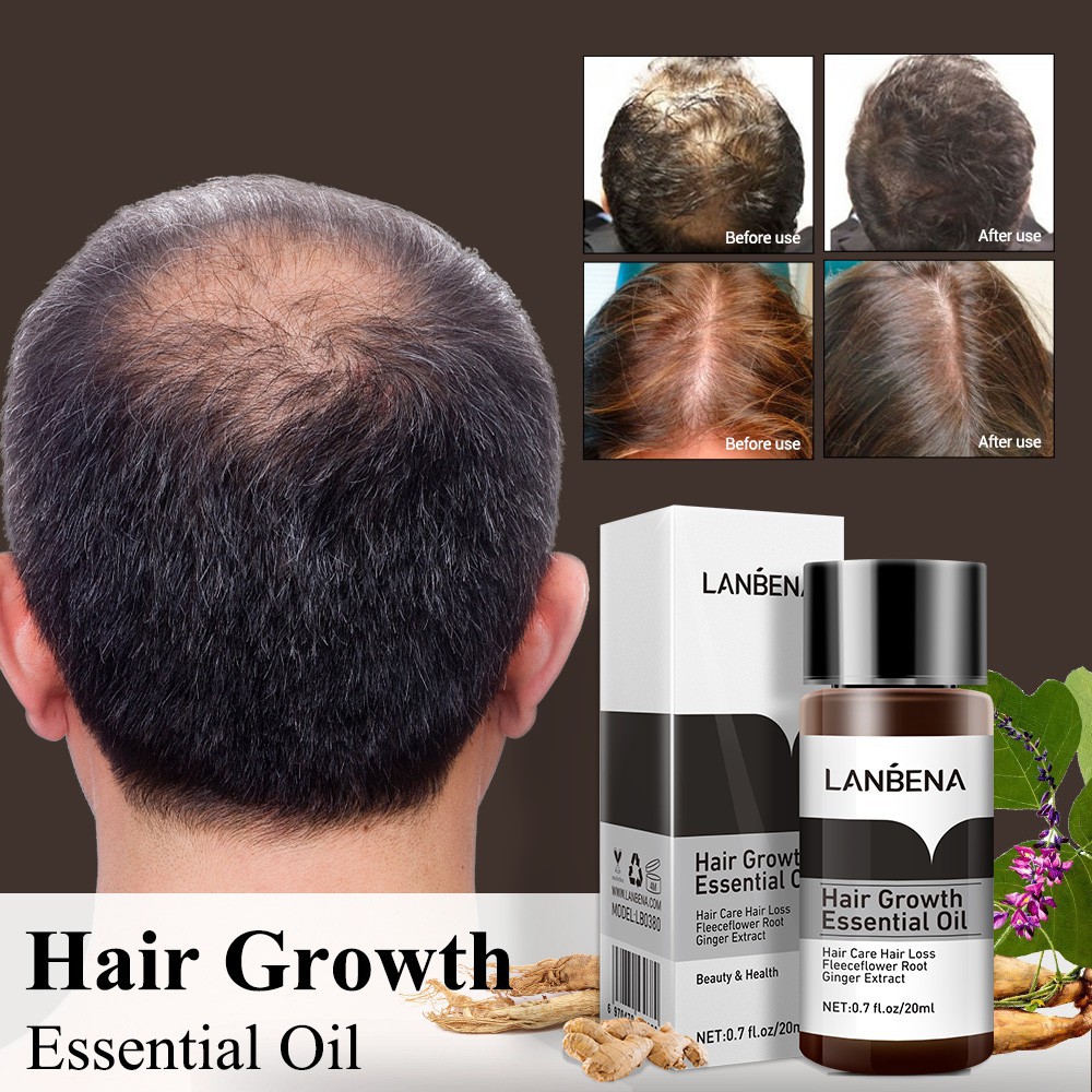 LANBENA HAIR SERUM PENUMBUH RAMBUT ANTI BOTAK 100% ORIGINAL GIRLSNEED77 Hair Growth Essential Oil