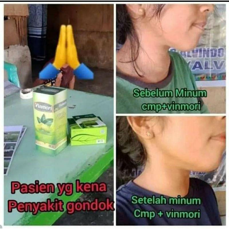 PAKET OBAT BENJOLAN GONDOK (VINMORI+NF CMP) JAMIN ORI HERBAL HALAL BPOM MUI