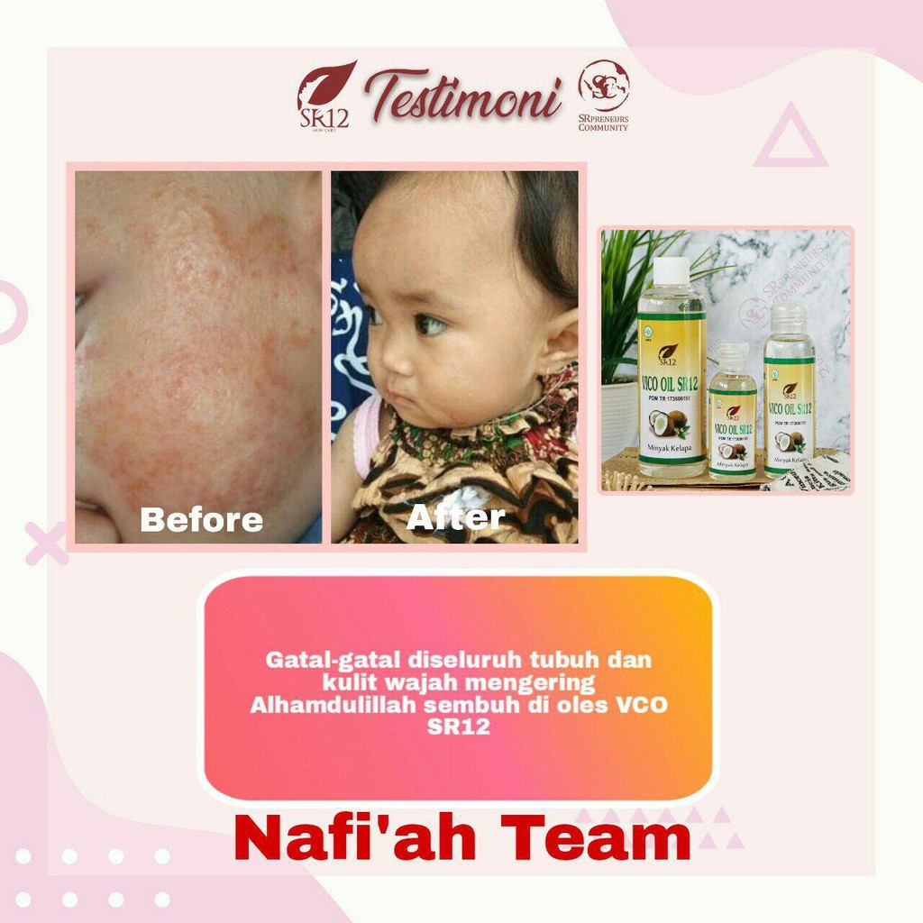 IMUN BOOSTER VCO MINYAK KELAPA MURNI SR12 / VICO VIRGIN COCONUT OIL 60ml / 100ml / 250ml / 60 Kapsul