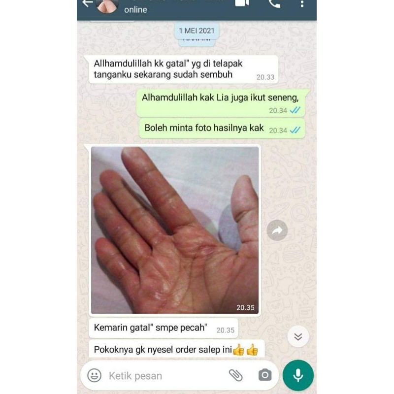 【READY STOK】 Salep BL Original 100% SCRUB untuk gatal shinsei exim panu kadas kurap,