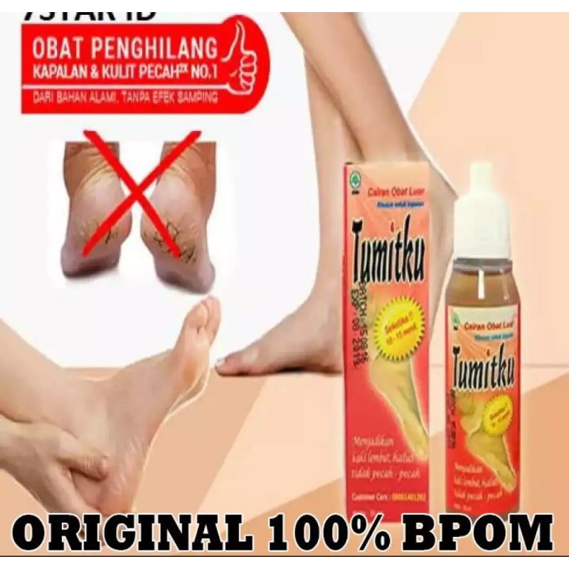 Tumitku Obat Kaki Pecah Kapalan Penghalus Tumit Kaki Obat Kapalan