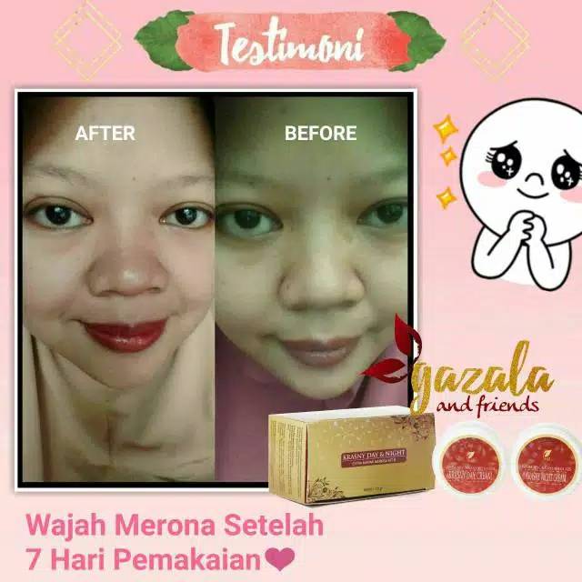 KRIM JERAWAT &amp; FLEK HITAM BPOM / KRASNY DAY &amp; NIGHT CREAM SR12 / KULIT KERING / MENCEGAH PENUAAN DINI / MELEMBABKAN