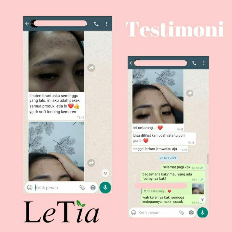 letia brightening rose series / paket advance / paket lengkap skincare