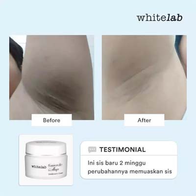 Whitelab Underarm Cream