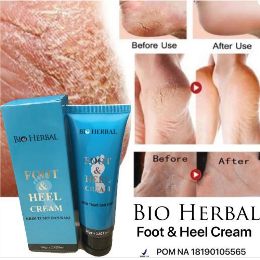 [ORI] KRIM PENGHALUS KAKI PECAH PECAH KASAR DAN KERING DALAM 7 HARI | Bio Herbal Foot and Heel Cream